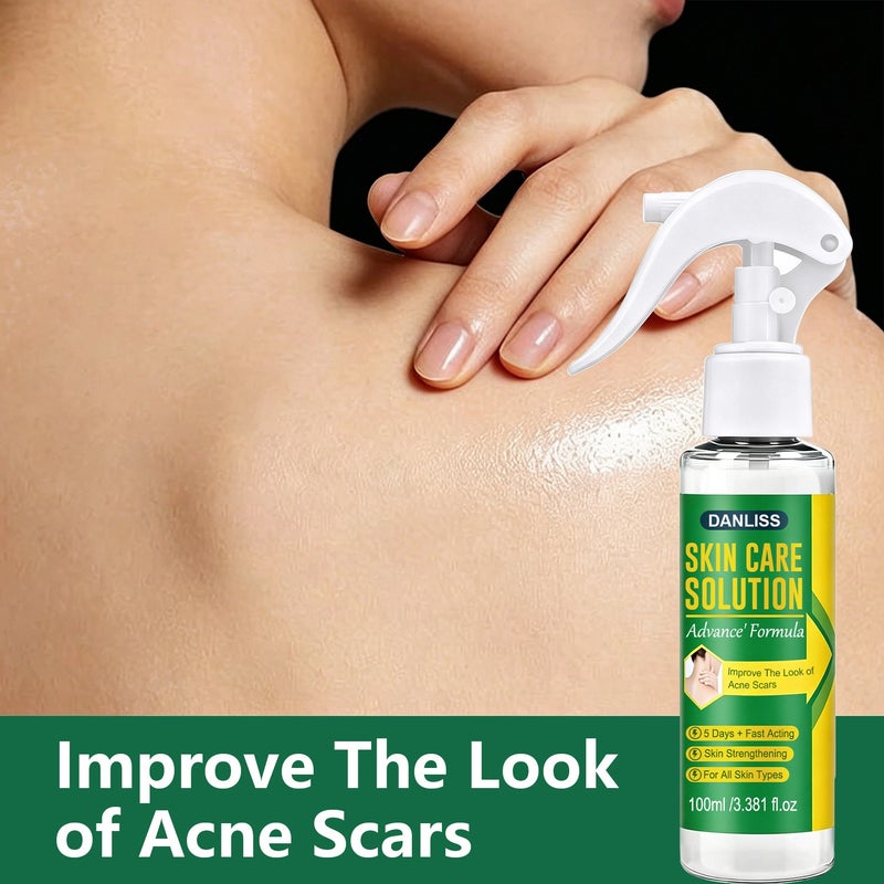 دانليس Danliss Advanced Acne Scar Repair Spray 100ml - يتلاشى بسرعة احمرار وندبات حب الشباب الداكنة في 5 أيام، ويعزز حاجز البشرة - Image 3