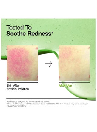 Azelaic Acid 10 Hyaluron Redness Soothing Serum 30ml - view 5