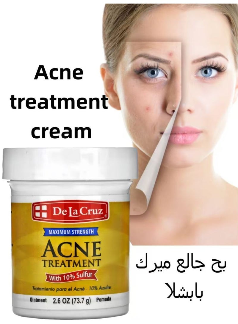 دي لا كروز ديلا كروز مرهم علاج حب الشباب بنسبة 10% كبريت - قوة قصوى 2.6 أوقية، مضاد للبكتيريا والالتهابات، للبثور والرؤوس السوداء، مختبر على الحساسية، للاستخدام اليومي، يخفف البقع - Image 1