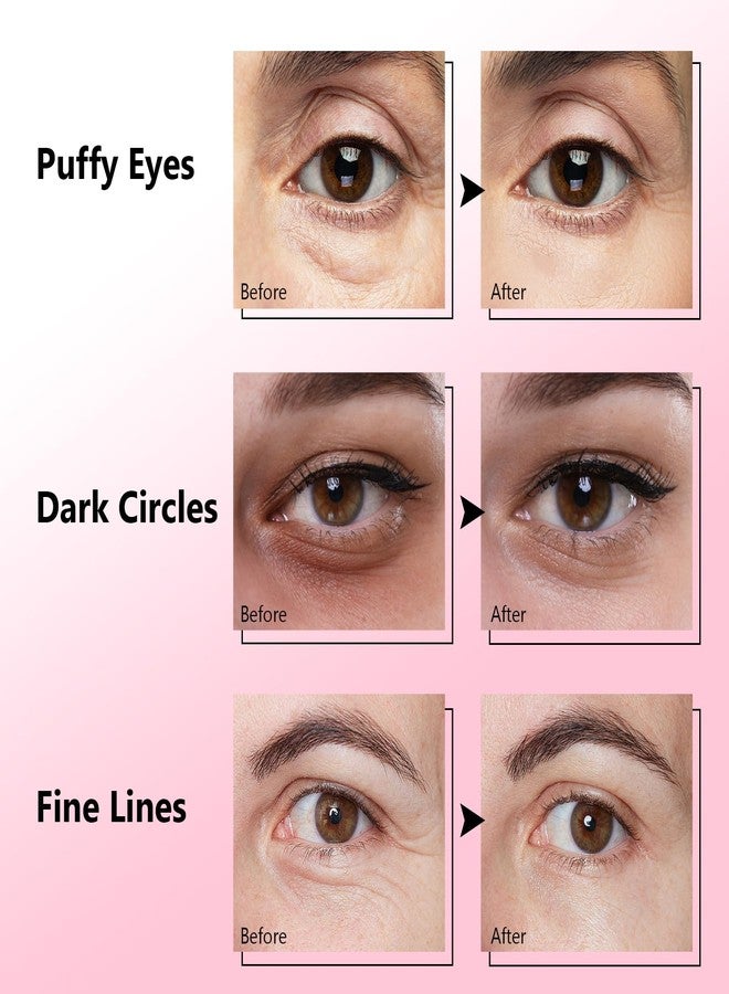Jakuva 30 Pairs Caffeine Under Eye Patches for Dark Circles & Puffy Eyes, Hydrating Under Eye Gel Masks with Hyaluronic Acid & Collagen, Travel Essentials & Self Eye Care Gifts for Women & Men - Image 4