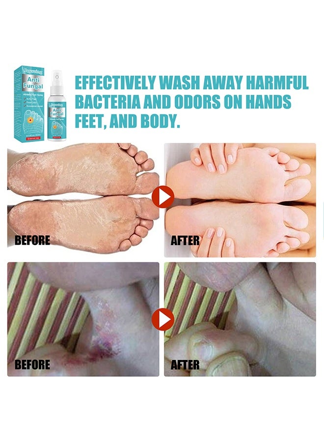Jaysuing Anti Fungal Athlete Foot Spray- Prevent Athlete's Foot,Smelly Feet,Relieve Itching of Feet, Sweating, Peeling And Blisters, Natural Ingredients Foot Fungi Spray For Tinea Pedis 50ml - Image 4