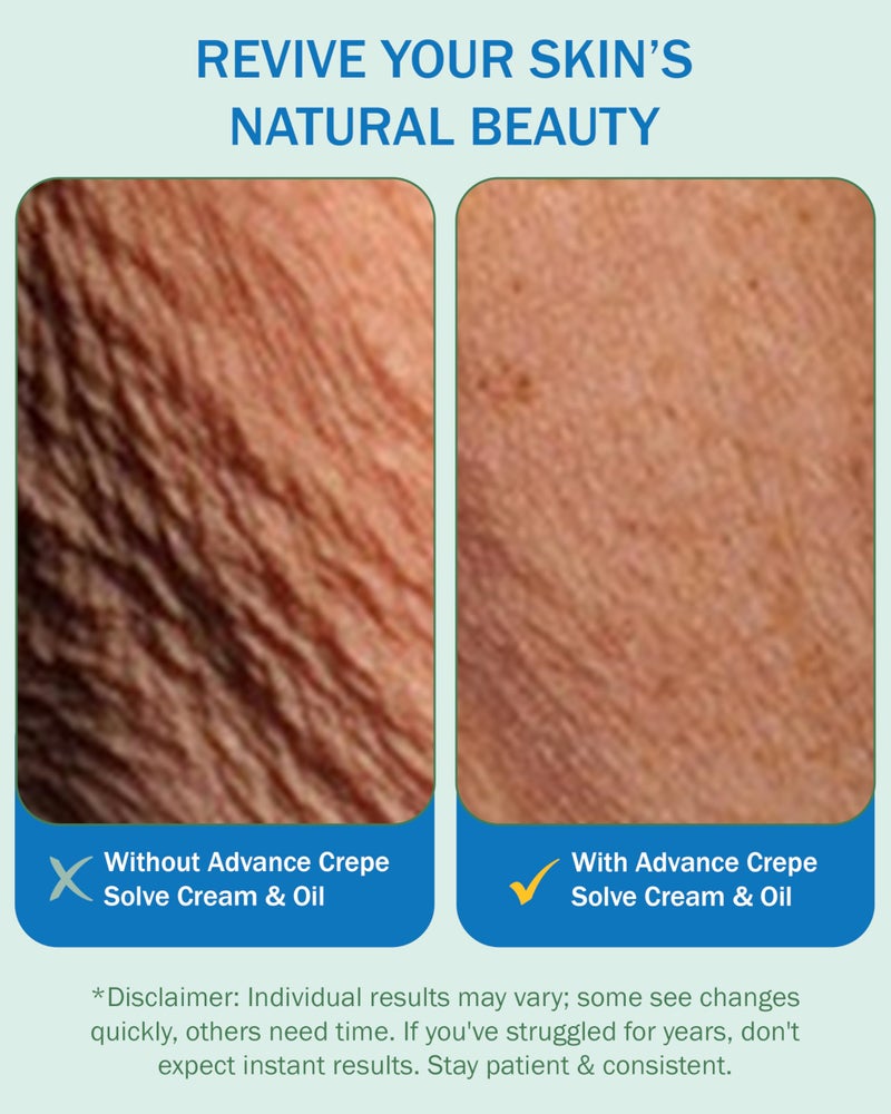 e70 Crepe Skin Erase Cream & Firming Oil Set (2 Pk, 4 Fl Oz each) - with Natural Oils, Licorice Root & Chamomile Extract - Crepey Skin Tightening and Firming Body Cream & Oil, Made in USA - Image 5