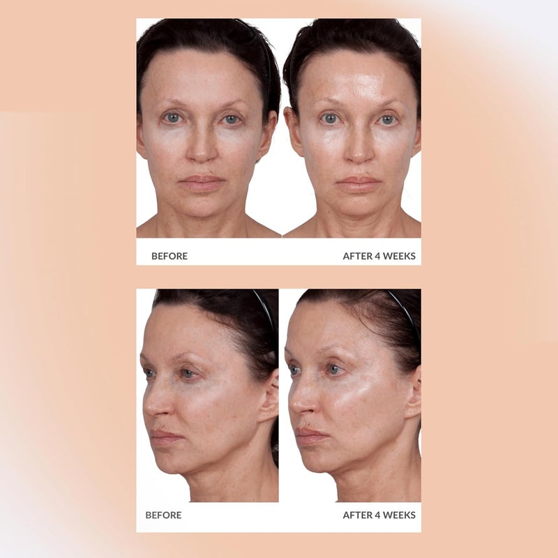 Consult Beaute Volumagen Collagen AntiAging Serum for the Face Hyaluronic Acid Skin Nourishing Plumping Hydrates and Temporarily Fills for Smoother Bouncy Skin 2 Oz Duo 2 Piece Set - Image 3