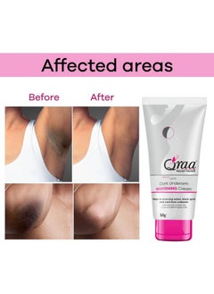 Qraa Advanced Lacto Dark Underarm Cream | For Uneven Skin Tone And Dark Underarms |Paraben Free | For Dark Body Parts Like Neck, Ankles, Knuckles, Armpits, Thighs, Elbows & Underarm (Small, 1)  - Image 4