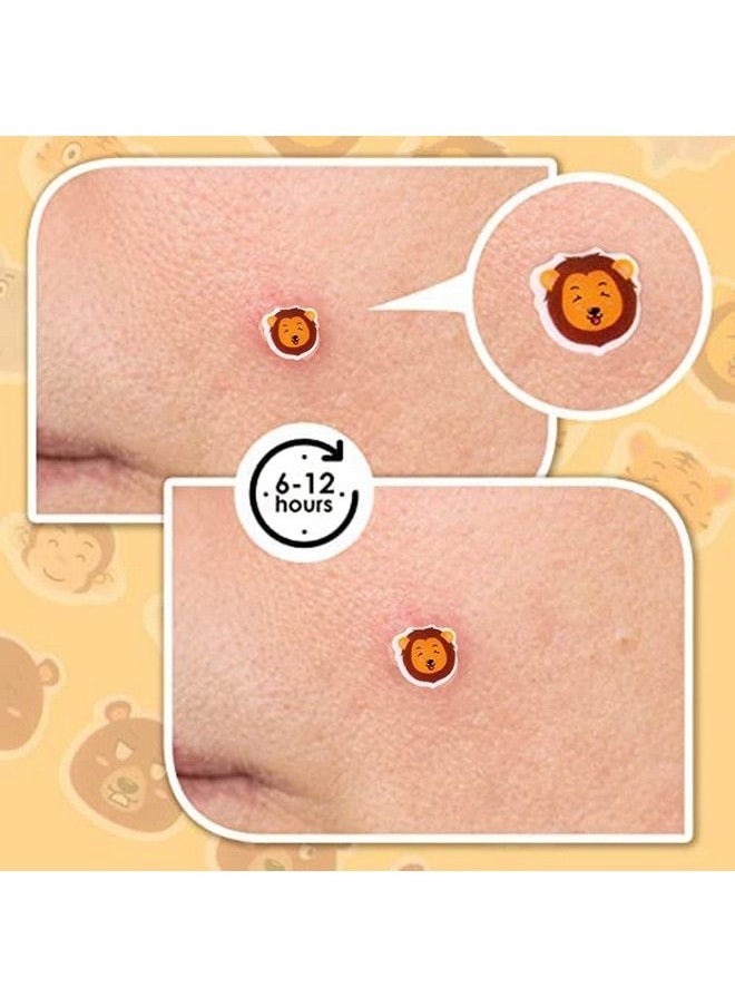 Animal Shape Pimple Patches 120 Patches Hydrocolloid Spot Dots Zit Breakouts Blemishes Patch Pimple Stickers Patches To Cover Facial Blemishes
