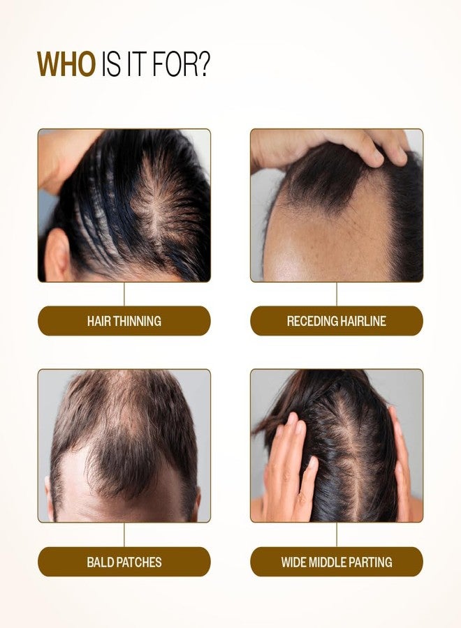 Bare Anatomy Advanced Hair Growth Serum Roll-On| 3% Redensyl + 4% Anagain + 2% Baicapil + 5% Rosemary, Rice Water, Biotin & Saw Palmetto| Reduces Hair Fall, Supports Hair Growth for Men & Women | 25ml-Pack of 2 - Image 3