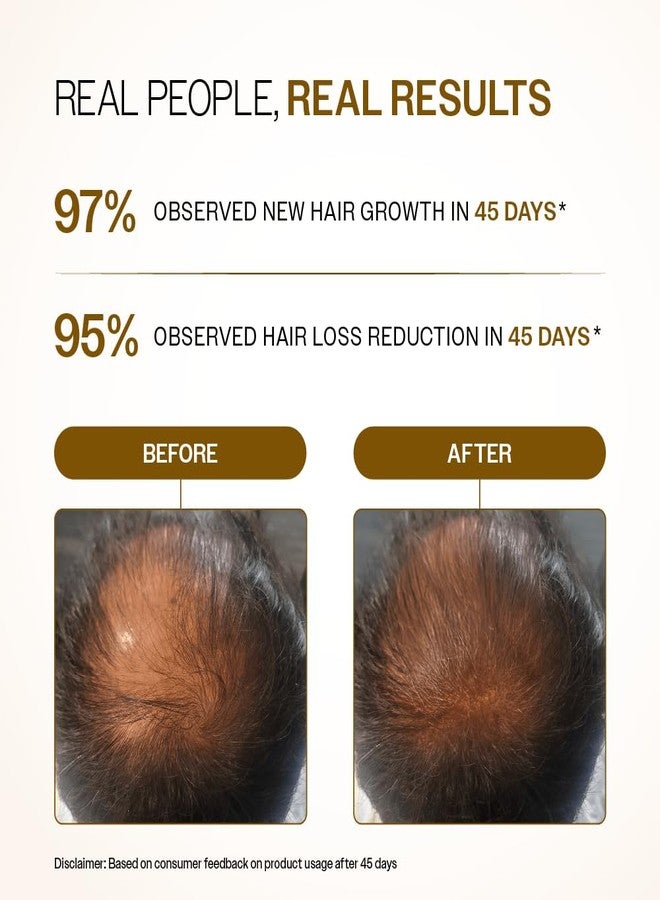 Bare Anatomy Advanced Hair Growth Serum Roll-On| 3% Redensyl + 4% Anagain + 2% Baicapil + 5% Rosemary, Rice Water, Biotin & Saw Palmetto| Reduces Hair Fall, Supports Hair Growth for Men & Women | 25ml-Pack of 2 - Image 4