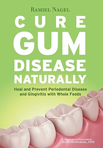 Cure Gum Disease Naturally Heal Gingivitis And Periodontal Disease With Whole Foods 
