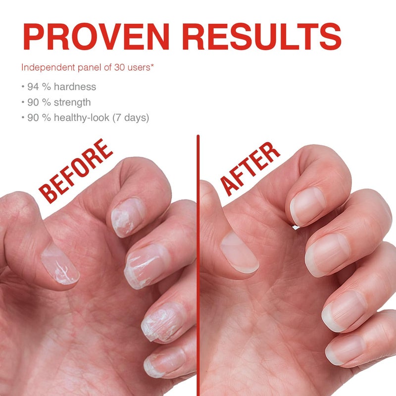 Probelle Nail Strengthener and growth, Natural Nail Strengthening Clear Nail Polish Repair Treatment, Nail Growth & Conditioning, Stops Splits, Chips, Cracks & Strengthens Damaged and Thin Nails - Image 4
