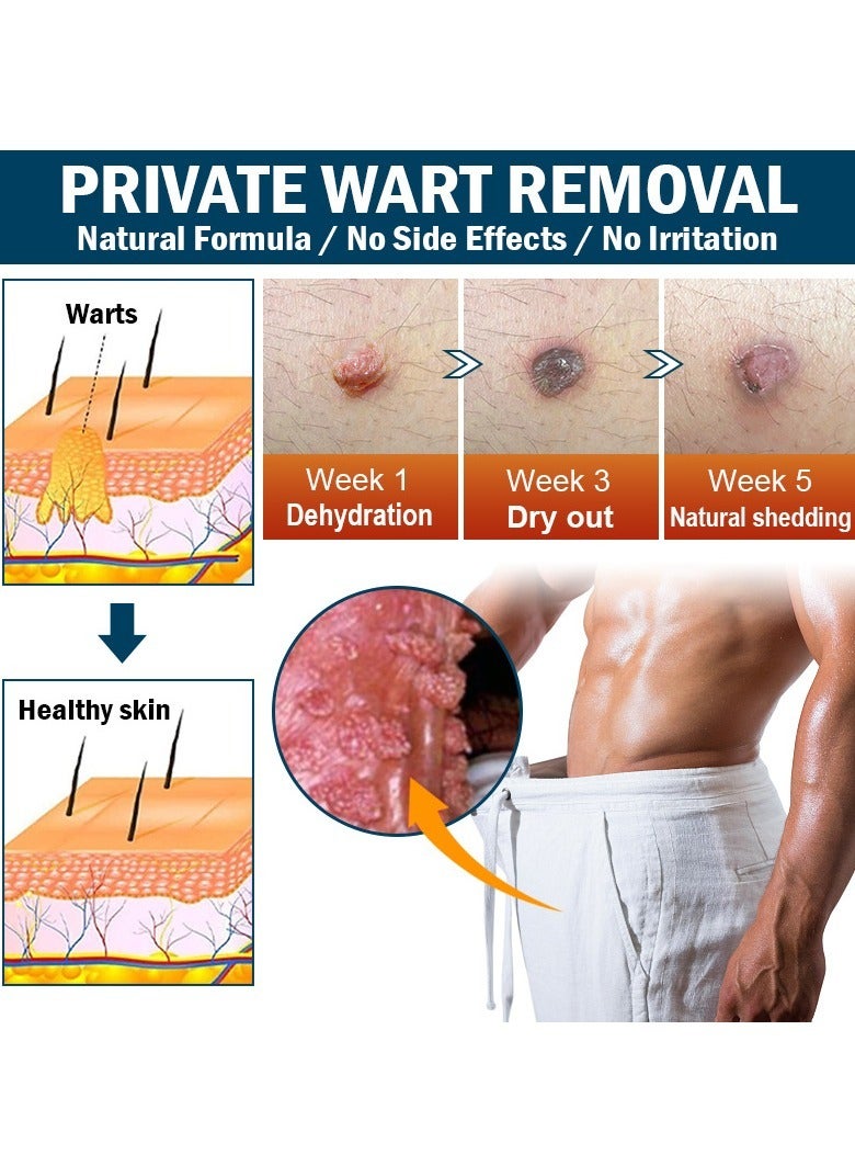 KanyeHB 2-PACK Wart Removal Cream,  Wart Remover for Genital Warts, Plantar Warts, Common Warts, Corns, Wart Cream 20g*2 - Image 4