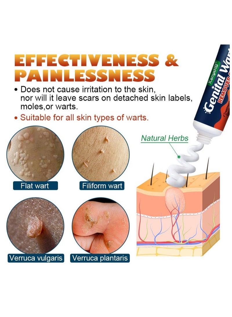 KanyeHB 2-PACK Wart Removal Cream,  Wart Remover for Genital Warts, Plantar Warts, Common Warts, Corns, Wart Cream 20g*2 - Image 3