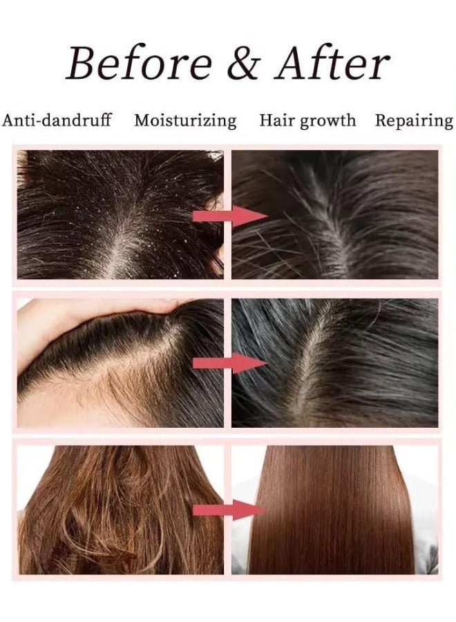 شامبو وبلسم وماسك للشعر وسيروم/زيت للشعر، مغذي للشعر وفروة الرأس، بزيت الأرغان العضوي ومستخلصاته، خالٍ من السيليكون والكبريتات. (مجموعة كاملة من 4 قطع) - Image 4