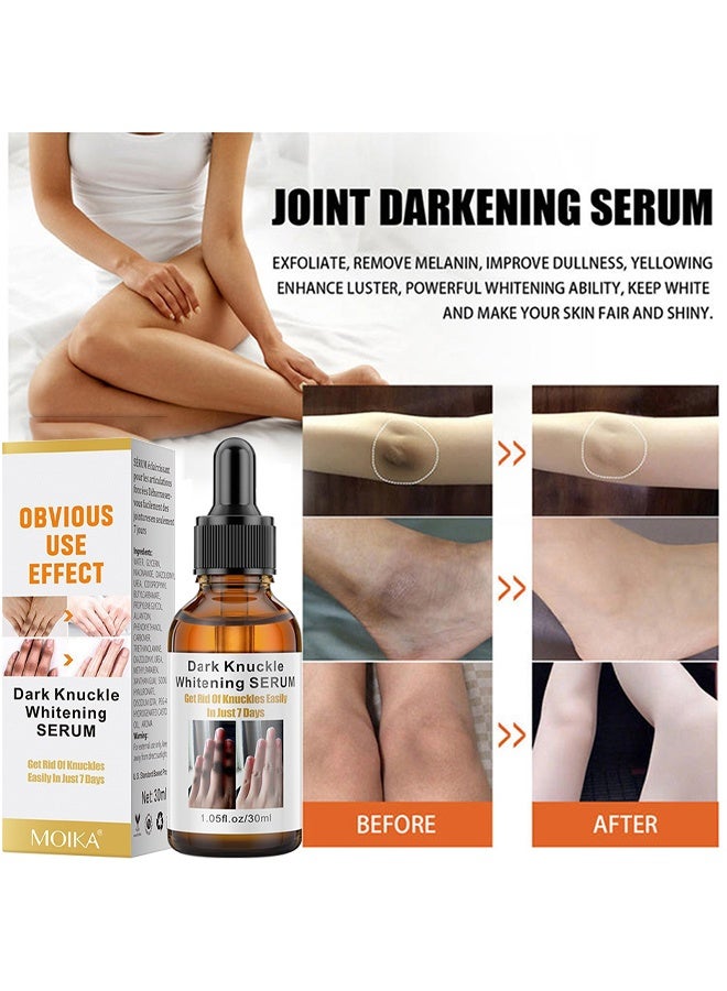 MOIKA Dark Knuckle Whitening Serum, Skin Body Bleaching For Dark Knees And Elbows, 7 Days Treatment For Dark Spots In Hand And Feet Knuckles Exfoliating Improves Dullness Powerful Whitening Effect For Men And Women, Moisturizing Strong Joint Whitening Serum, 30ML - Image 4