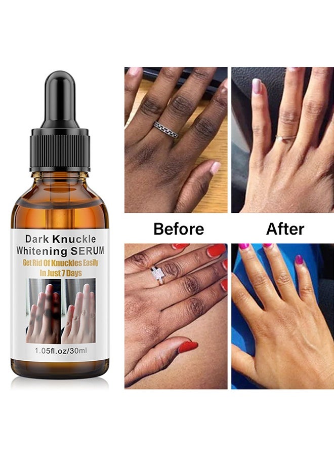 MOIKA Dark Knuckle Whitening Serum, Skin Body Bleaching For Dark Knees And Elbows, 7 Days Treatment For Dark Spots In Hand And Feet Knuckles Exfoliating Improves Dullness Powerful Whitening Effect For Men And Women, Moisturizing Strong Joint Whitening Serum, 30ML - Image 2