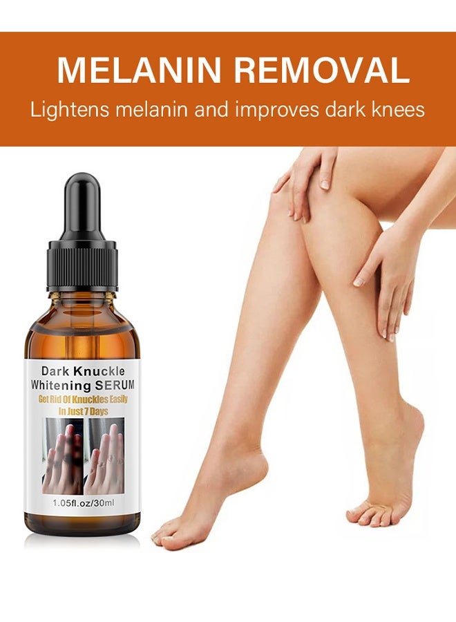 MOIKA Dark Knuckle Whitening Serum, Skin Body Bleaching For Dark Knees And Elbows, 7 Days Treatment For Dark Spots In Hand And Feet Knuckles Exfoliating Improves Dullness Powerful Whitening Effect For Men And Women, Moisturizing Strong Joint Whitening Serum, 30ML - Image 5