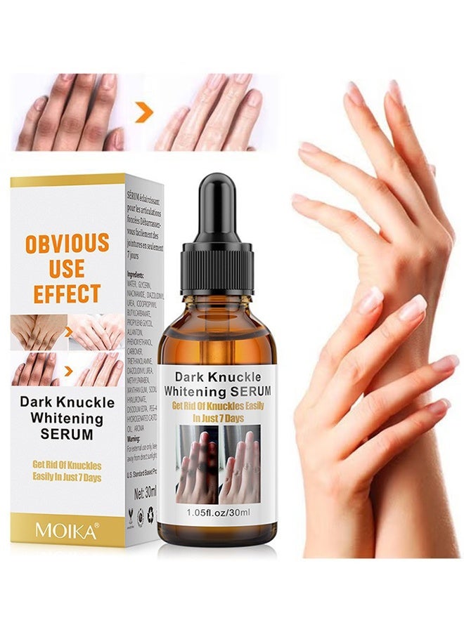 MOIKA Dark Knuckle Whitening Serum, Skin Body Bleaching For Dark Knees And Elbows, 7 Days Treatment For Dark Spots In Hand And Feet Knuckles Exfoliating Improves Dullness Powerful Whitening Effect For Men And Women, Moisturizing Strong Joint Whitening Serum, 30ML - Image 1