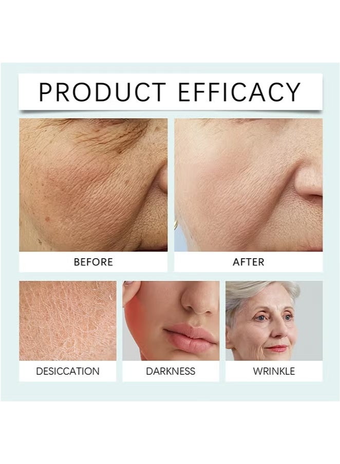 هويجي كريم تجديد الوجه ، كريم تجديد كريم الوجه مضاد للتجاعيد كريمة الوجه الوجه ، الكريمة الوجه مشرق ، بقش بقع داكنة ، كريم تجاعيد لجميع أنواع البشرة ، سام وجه كريم كوري 50 جرام - Image 3