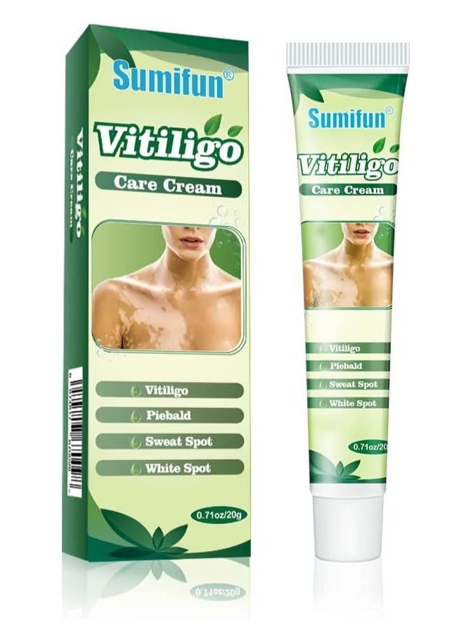 Sumifun 2 Pcs Vitiligo Care Cream Reduces White Spots on Skin Pigmentation Regulating Improve Skin Pigmentation Upgraded Vitiligo Creams - Image 1