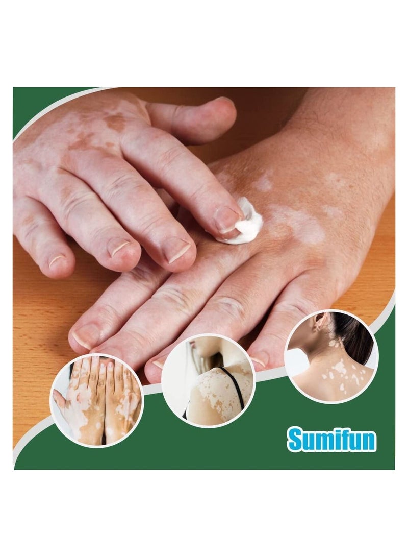 Sumifun 2 Pcs Vitiligo Care Cream Reduces White Spots on Skin Pigmentation Regulating Improve Skin Pigmentation Upgraded Vitiligo Creams - Image 4