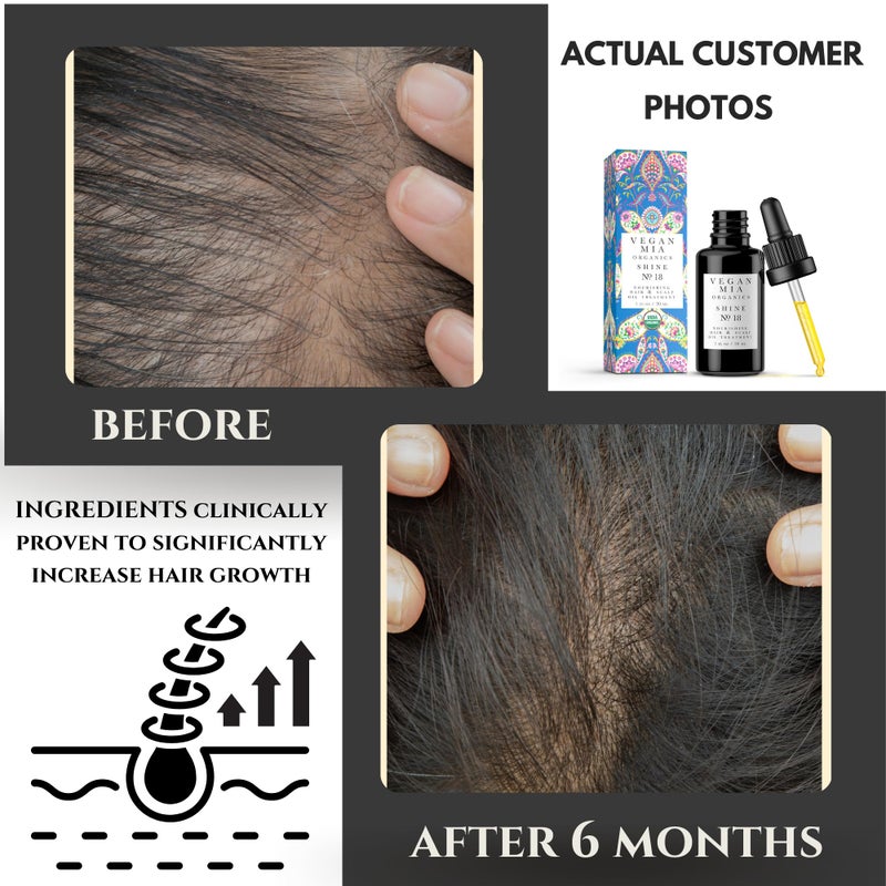 Vegan Mia USDA Organic Rosemary Oil for Hair Growth with Castor, Jojoba & More by Vegan Mia | for Intense Nourishment & Dry Scalp Treatment - Get Healthier, Thicker & Shiny Hair Naturally (with Exclusive eBook) - Image 2