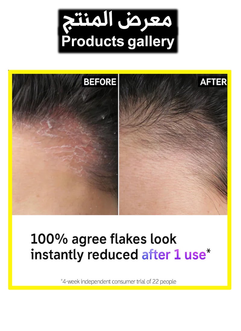 The Inkey List Salicylic Acid Exfoliating Scalp Treatment 150ml  - Image 3