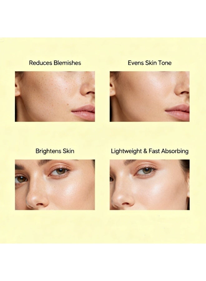 Denefis Anti Blemish Even Skin Tone Serum 30ml - Image 5