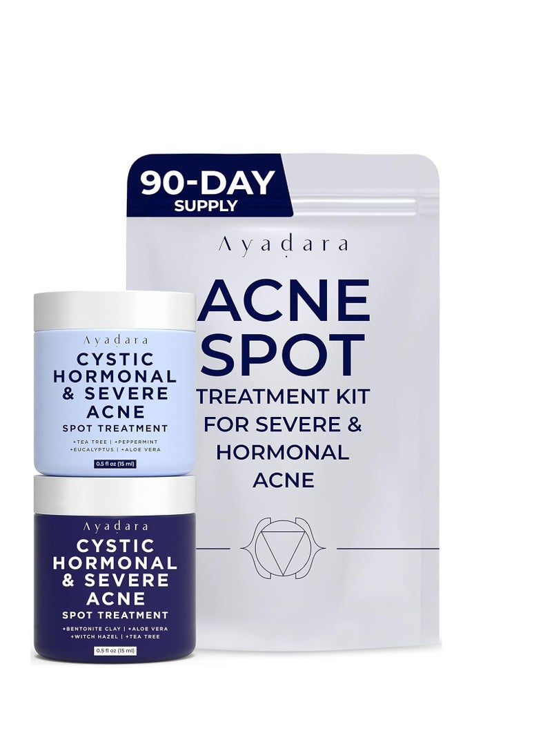 AYADARA Day & Night Cystic Acne Spot Treatment, Hormonal Acne Treatment For Daytime & Overnight, Severe Acne, Cystic Acne Treatment for Face, Pimple Cream Tea Tree Bentonite Clay, 90 Day Supply