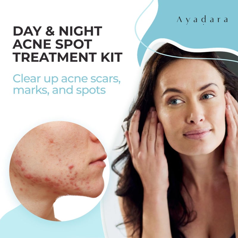 Ayadara Day & Night Cystic Acne Spot Care for Skin, Hormonal Acne Support for Daytime & Overnight, Cystic Acne Skin Balancing Formula for Face, Acne Cream with Tea Tree & Bentonite Clay, 90 Day Supply - Image 2