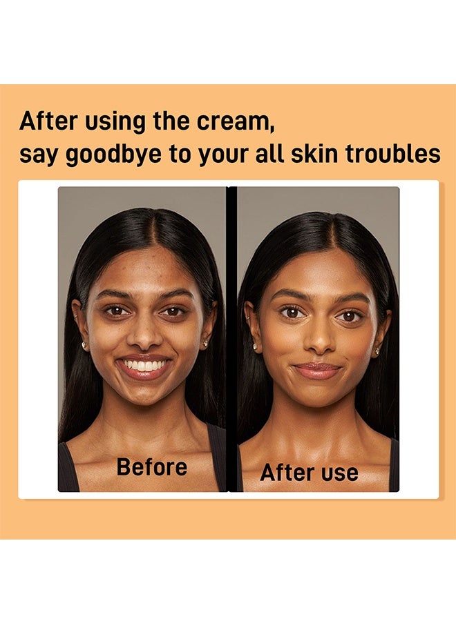 روبيريل كريم الكركم + حمض الكوجيك ، يهدئ التجاعيد ، مضاد للشيخوخة وتفتيح ، يضيء البشرة ، يزيل حب الشباب ، التبييض ، البقع التفتيح 50 جم - Image 4