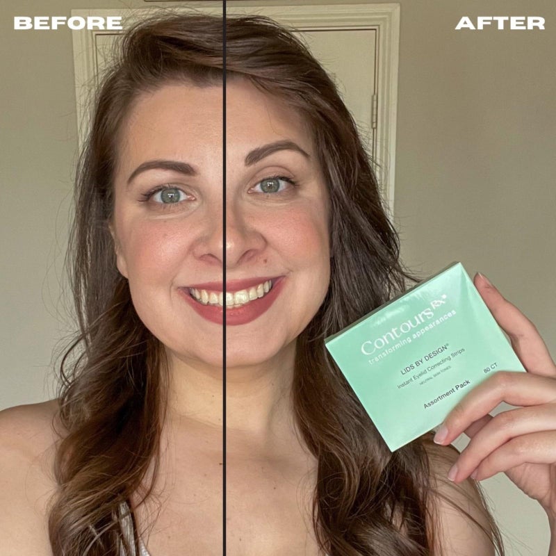 Contours Rx Lids by Design â€“ NÂ°3 Invisible Instant Eyelid Lift Strips for Slight Hooded, Droopy & Heavy Lids â€“ Medical-Grade, Non-Surgical Eye Lift Tape â€“ 80 Count - Image 2