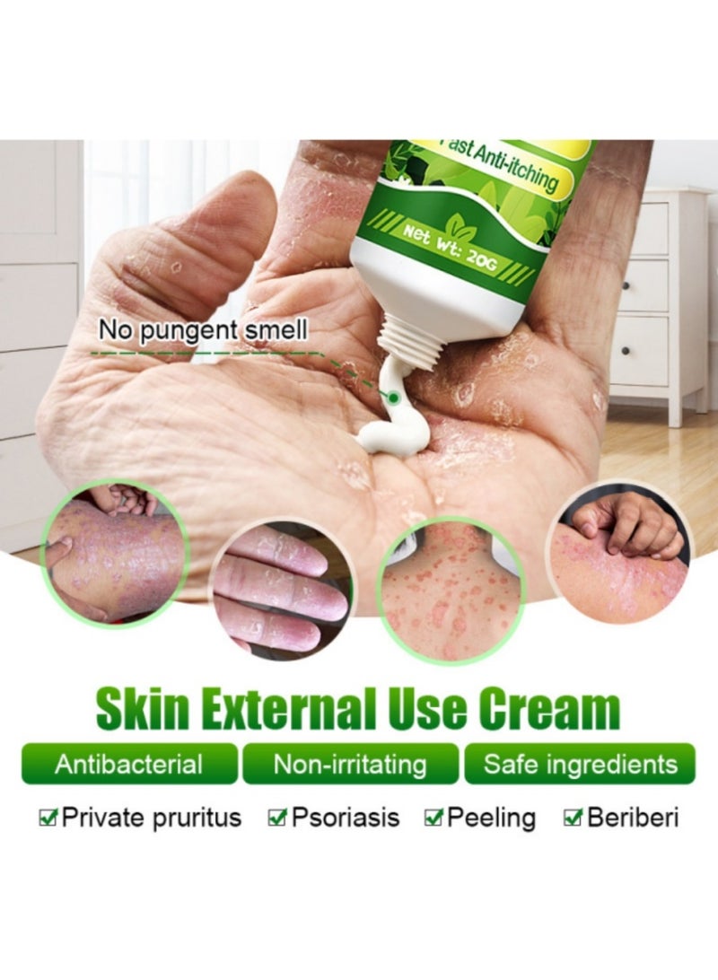 كاني إتش بي قطعتان، كريم مضاد للبكتيريا للصدفية والأكزيما، كريم مضاد للفطريات، يساعد على الأكزيما، كريم مضاد للحكة مع مكونات عشبية لطيفة وأكثر أمانًا، يخفف الحكة للوجه والجسم بسرعة - Image 4