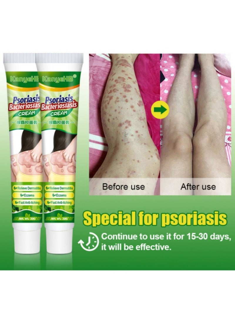 كاني إتش بي قطعتان، كريم مضاد للبكتيريا للصدفية والأكزيما، كريم مضاد للفطريات، يساعد على الأكزيما، كريم مضاد للحكة مع مكونات عشبية لطيفة وأكثر أمانًا، يخفف الحكة للوجه والجسم بسرعة - Image 5