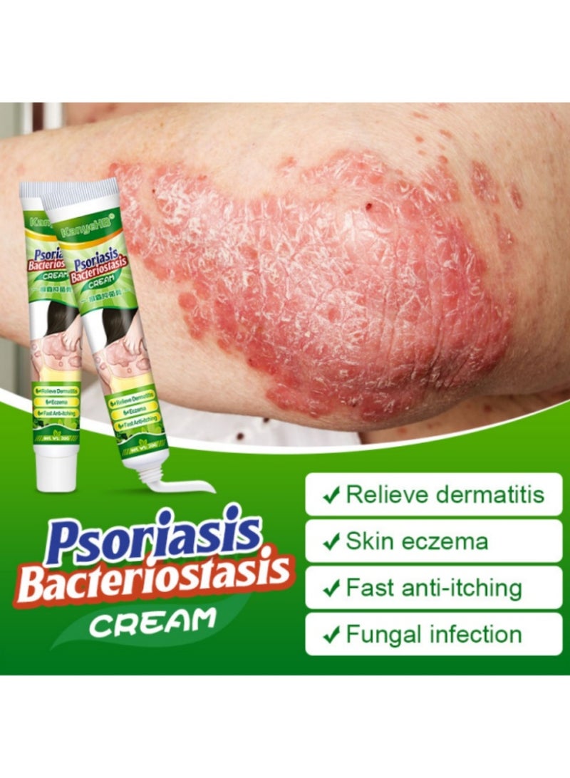 كاني إتش بي قطعتان، كريم مضاد للبكتيريا للصدفية والأكزيما، كريم مضاد للفطريات، يساعد على الأكزيما، كريم مضاد للحكة مع مكونات عشبية لطيفة وأكثر أمانًا، يخفف الحكة للوجه والجسم بسرعة - Image 3