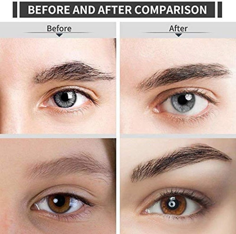 Electric Eyebrow Trimmer & Epilator with Light – Painless Hair Removal for Women, Multifunctional and Upgraded Design, Precise and Gentle for Eyebrows, Face, and Body