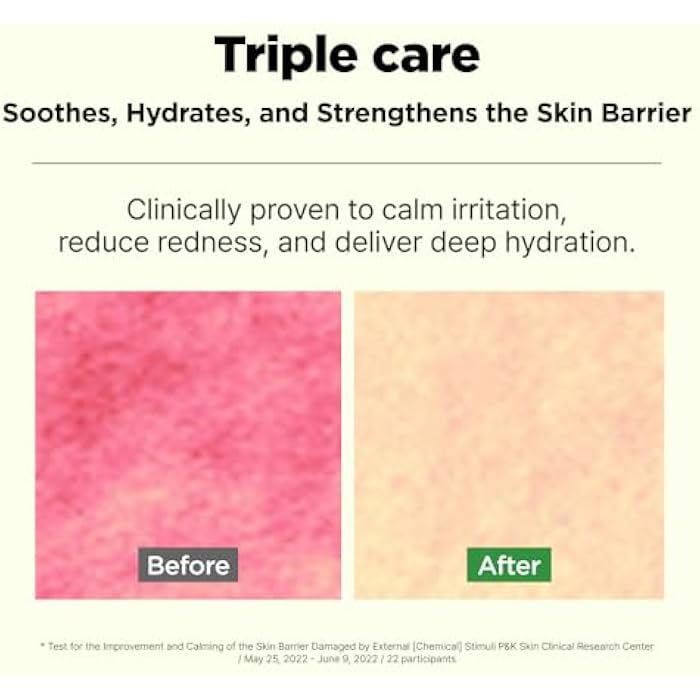 ISOI Moisture Dr. Soothing Toner, Lightweight Hydrating Toner for The Face with Tea Tree Ceramide & Hyaluronic Acid for Skin Barrier Support, Korean Skin Care (4.39 fl. oz/130ml) - Image 3