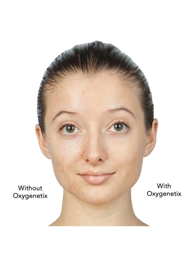 oxygenetix Oxygenating Foundation - 15ml - Opal - Image 4