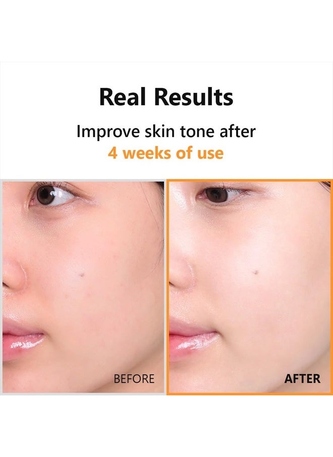 ISNTREE - Hyper Vitamin C 23 Serum 20ml - Image 1