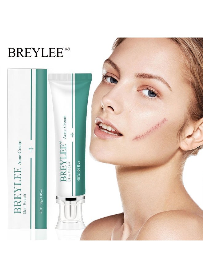 Skin Repair Acne Cream,-promote the regeneration of collagen, fade scars, improve scar skin, deep moisturizing skin