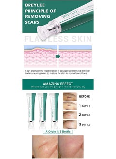 Breylee Skin Repair Acne Cream,-promote the regeneration of collagen, fade scars, improve scar skin, deep moisturizing skin  - Image 2