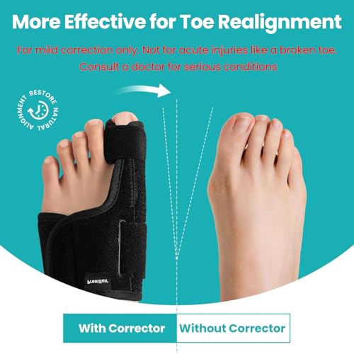 Promifun Toe Splint for Broken Toes - Big Toe Splint for Women & Men - Support Brace for Day & Night Use - Bunion Corrector - 1 Pair - Image 2