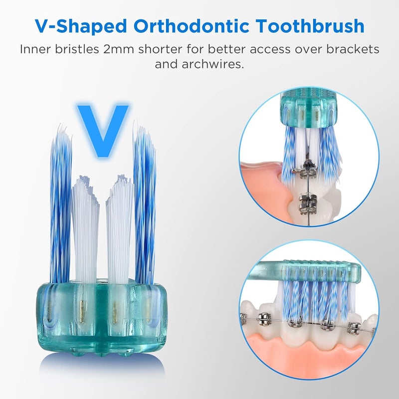 Fregum V-Shaped Orthodontic Toothbrush for Braces with 6 Interdental Brushes, Soft Bristles, 6 Count - Image 2