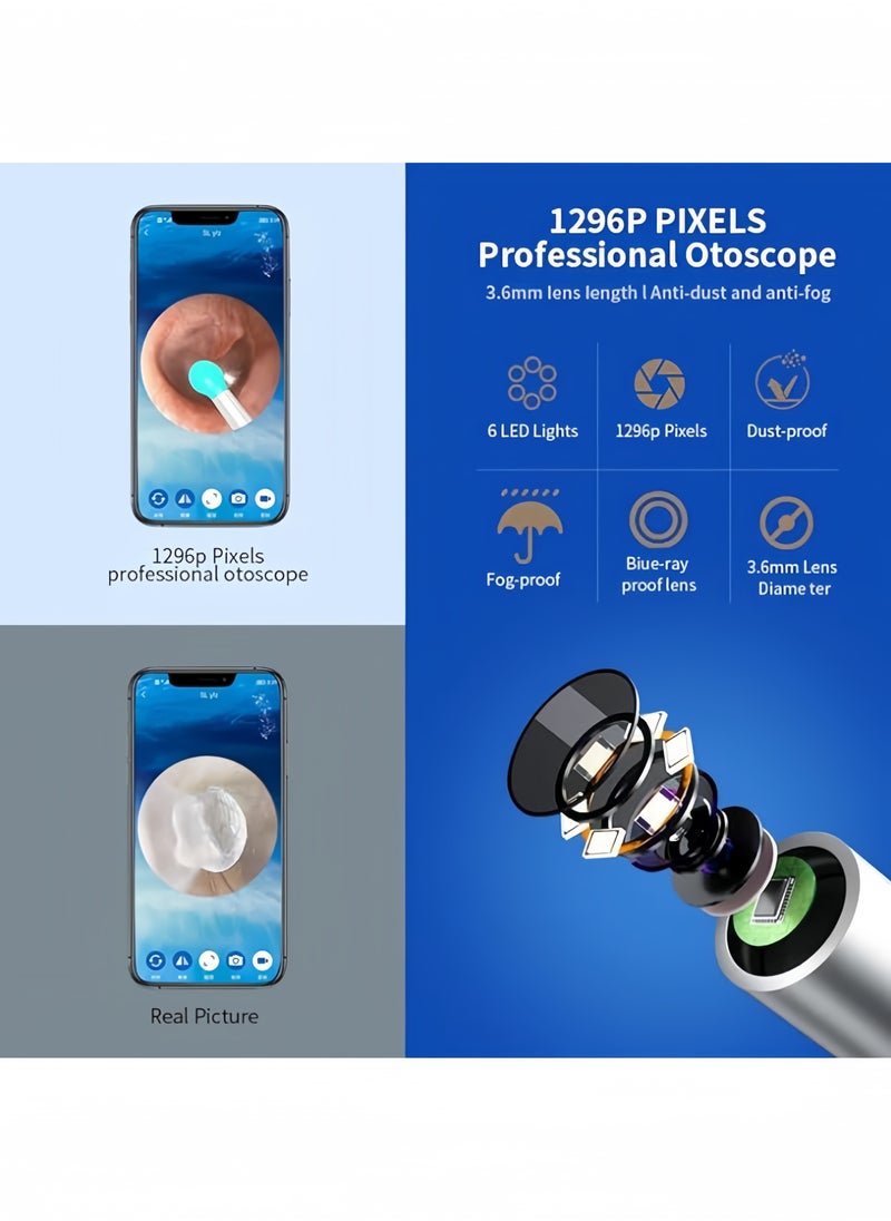 Generic - Ear Cleaner,Wi-Fi Visible Wax Elimination, High Precision Ear Wax Removal Tool with Camera LED Light Wireless Otoscope Smart Ear Cleaning Kit,for iPhone, iPad, Android Phones(Black) - Image 1