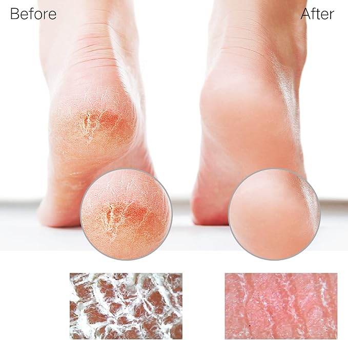 Sunivaca Foot Files for Hard Skin Glass Foot File Callus Remover for Feet Fast Easy Essential Feet Hard Skin Remover Professional Salon Pedicure Tool for Soft Smooth Heels - Image 4