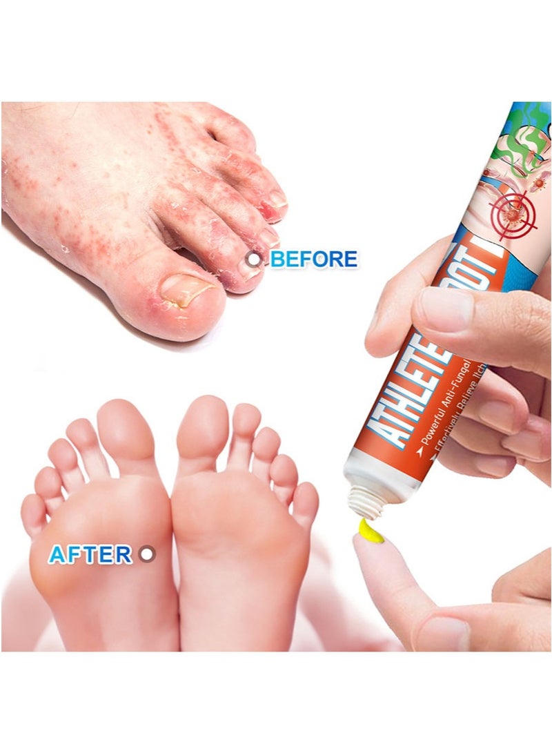 Sumifun 2 Piece Athletes' Foot Cream And Athletes' Foot Spray Care Set，Foot Odor Treatment，Sweaty Feet，Peeling And Itchy Sole Care （20g + 30ml） - Image 3