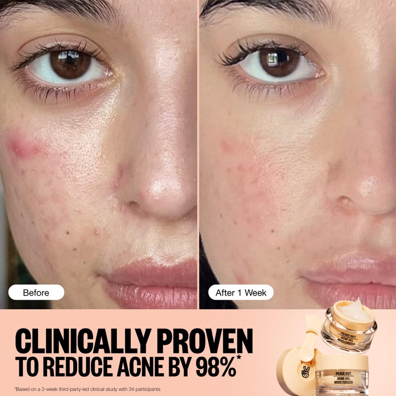 PEACE OUT Skincare Acne Gel Moisturizer, For Daily Facial Use with Salicylic Acid & Niacinamide, Boost Hydration and Help Prevent Acne & Blackheads, for Men & Women, 1.69 fl oz - Image 3