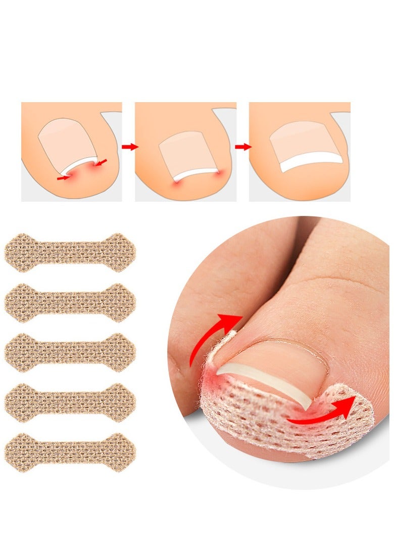 30 Toenail Correction Patches - Image 2