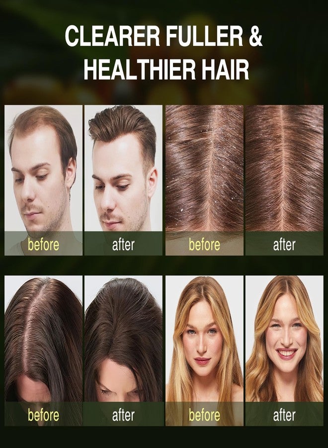 ulluxe Batana Oil Hair Growth Shampoo, Strengthening Regrowth Shampoo for Men & Women with Thinning Hair & Hair Loss, Infused Rosemary, Mint Oil Nourishes Scalp, Sulfate Free for All Hair Types, 10.15 fl.oz - Image 3