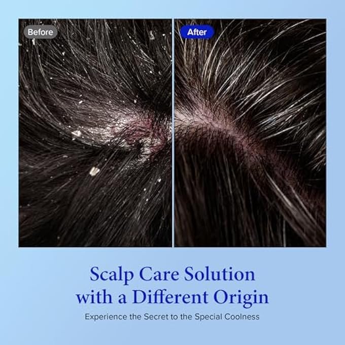 KUNDAL SHAMPOO, HAIR SCALP CARE - AQUA MINT REFRESHING COOL SHAMPOO WITH EUCALYPTUS, TEA TREE EXTRACTS, ARGAN OIL 10.14 FL.OZ, PACK OF 2 - Image 2