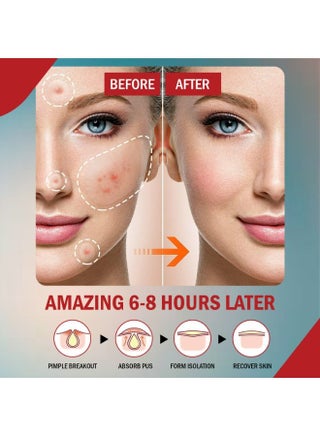 108 Pcs Miracle Pimple Patches Hydrocolloid Patches,Acne Pimple Patches for Face,Circle Facial Hydrocolloid Acne Patch,Master Blemish Patches,Acnes Spot Cover Stickers with Tea Tree Oil Invisible Acne Pimple Patches Blackhead Remover Patch - view 4