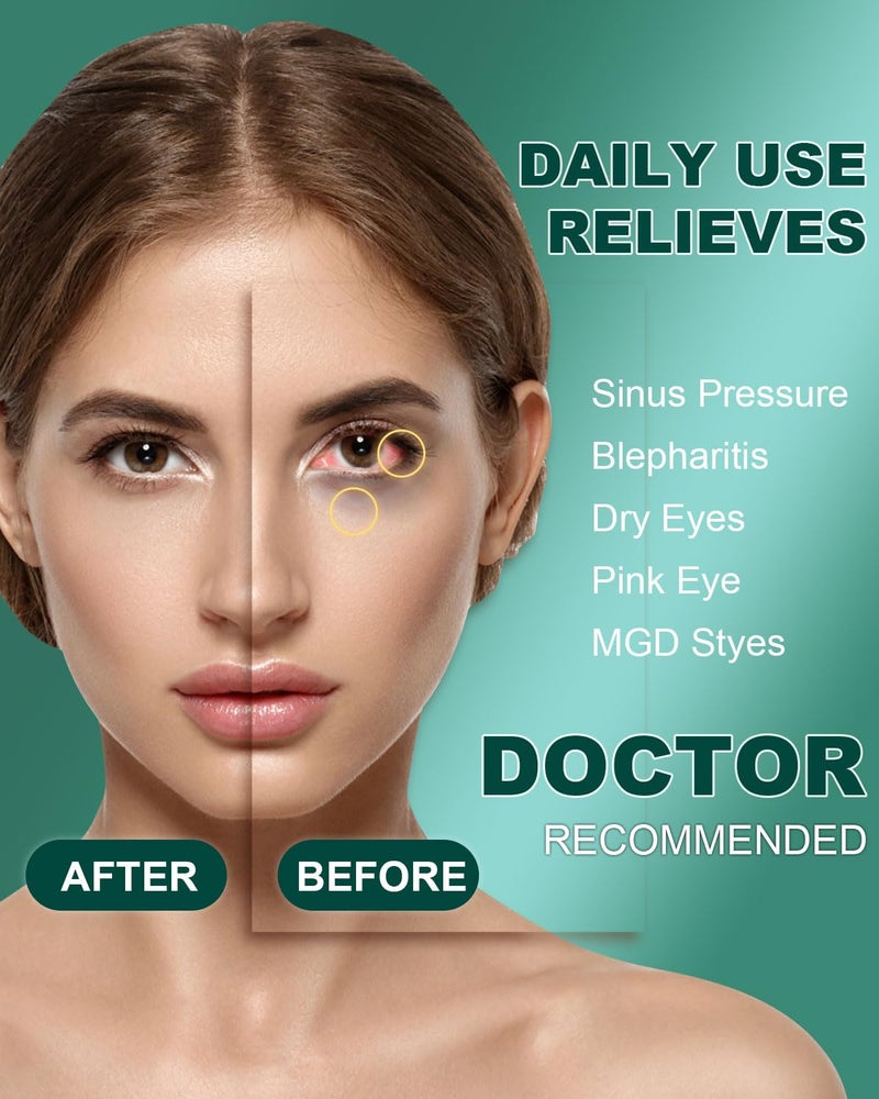 ProCIV 30 Packs Steam Eye Mask,Warm Compress for Dry Eyes Sleep Mask,Hot Auto Heated Eye Masks Relaxing Products for Women Moist Heat Soothing Eye Fatigue,Disposable Eye Mask for SPA Essentials - Image 3